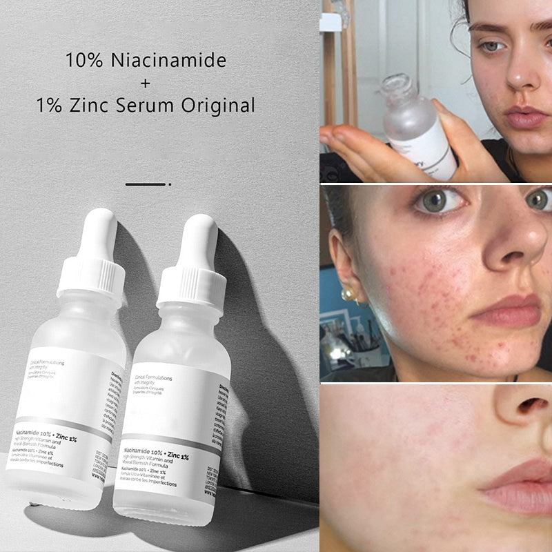 The Ordinary Niacinamide 10% + Zinc 1% Serum 100% Original + Barcode S ...